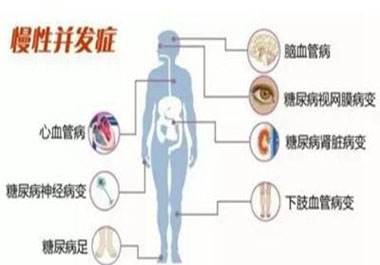 遠(yuǎn)離高血糖并發(fā)癥，請(qǐng)記住一點(diǎn)，學(xué)會(huì)“補(bǔ)硒”