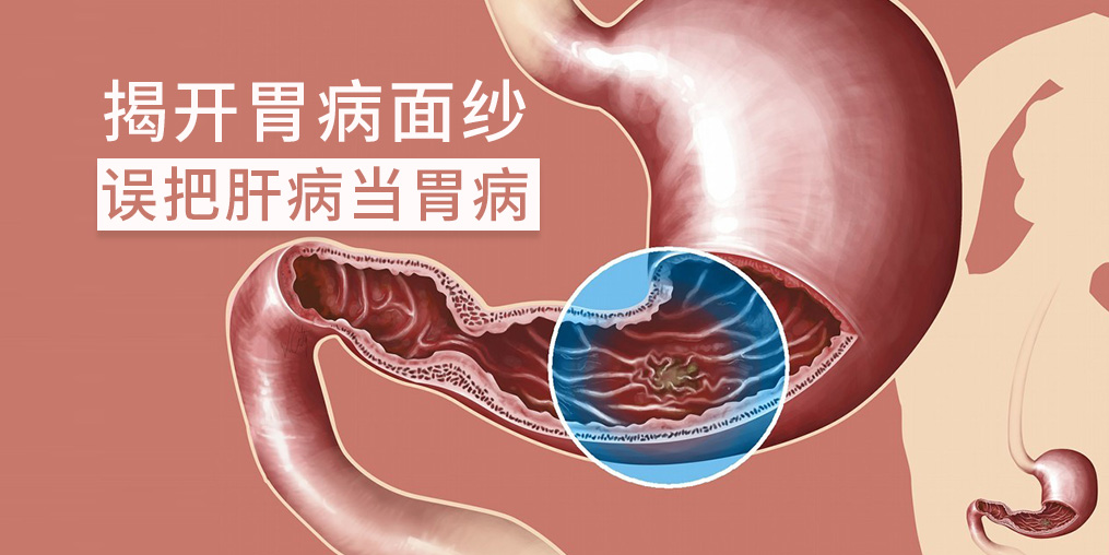 警惕“假胃病”，小心是肝有問題